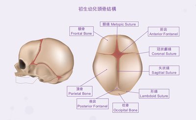 交通意外腦創傷索償：成功索償的文件清單